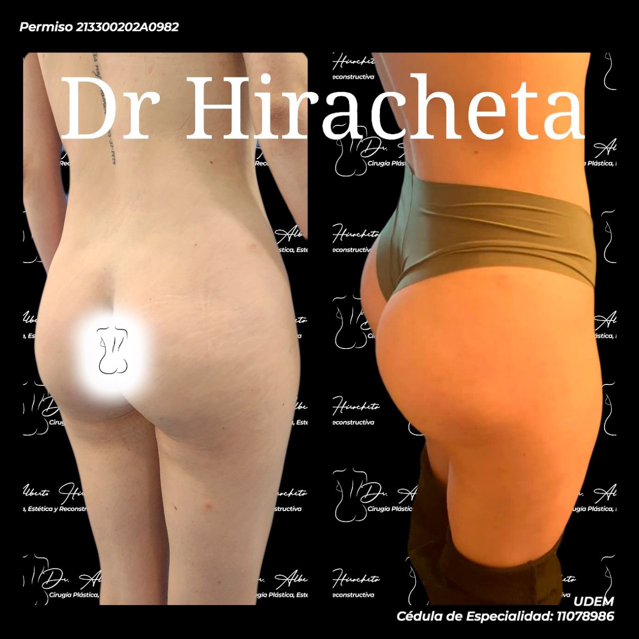 Alberto Hiracheta Torres-24