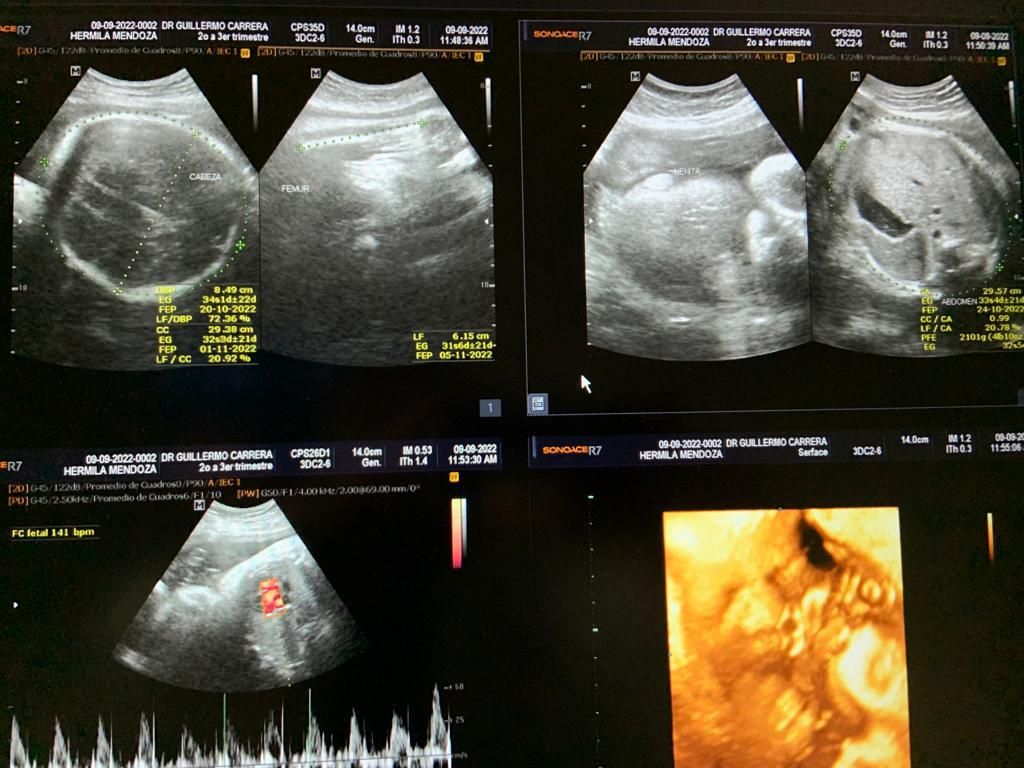 Guillermo Carrera Franco-3