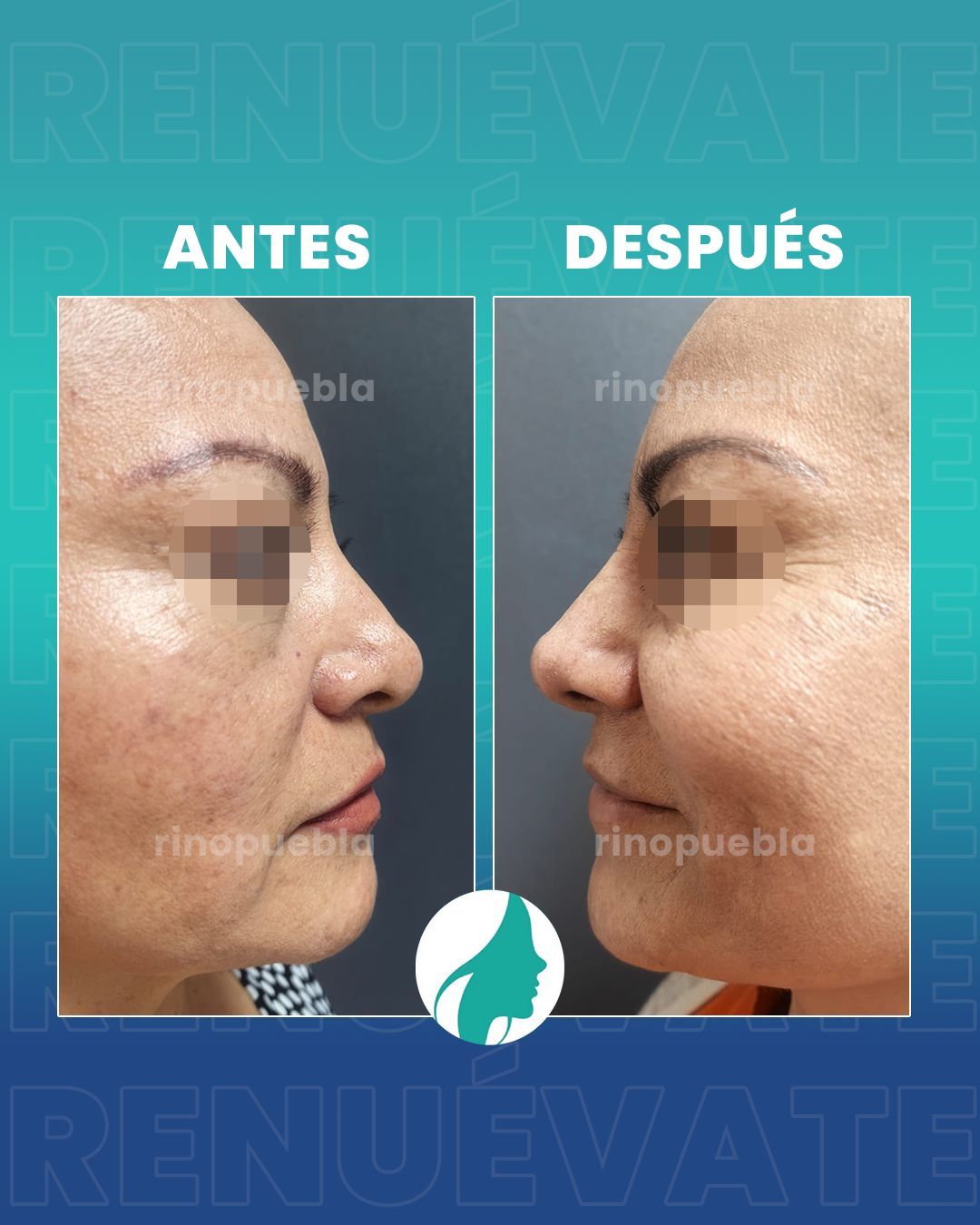 Christian Santander Becerra-15