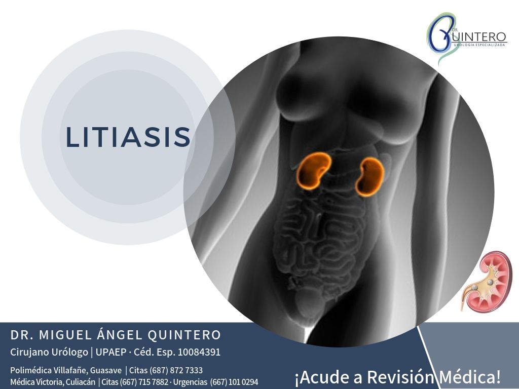 Miguel Ángel Quintero León-3