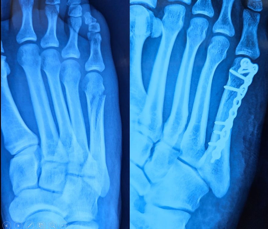 Luis Castañón Robles-3