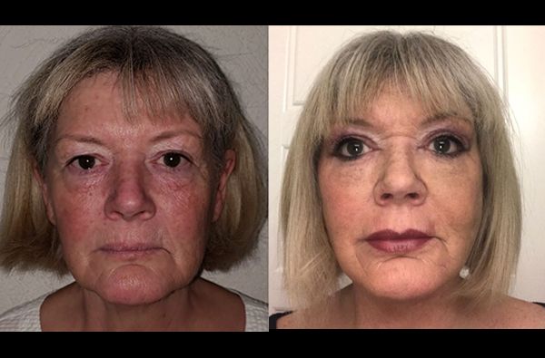 Edgar Ernesto Torres Mejía-31