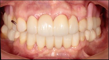 Mariel Itzayani Torres López-13