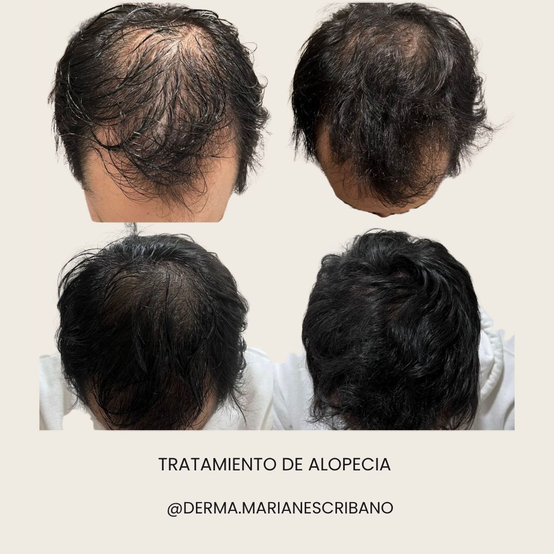 Marian Escribano Ponce-8
