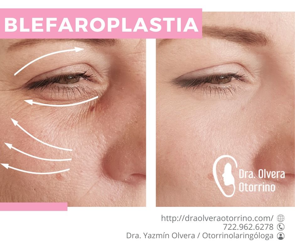 Ma. Yazmín Olvera Suárez-18