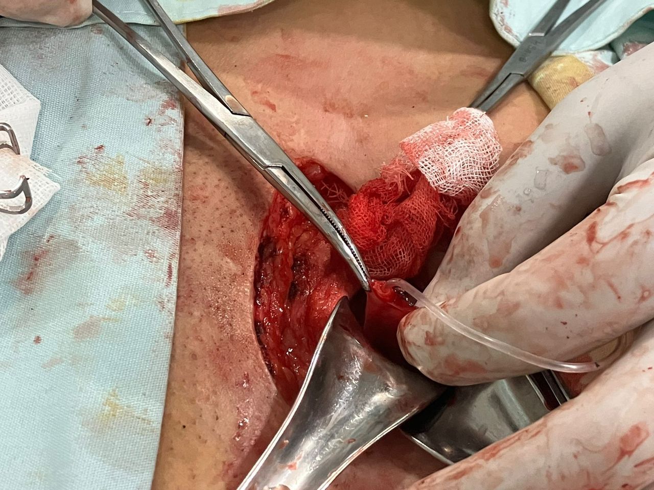 Marco Aurelio Corona Hernandez-27