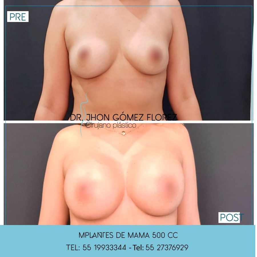 Jhon César Gómez Florez-19