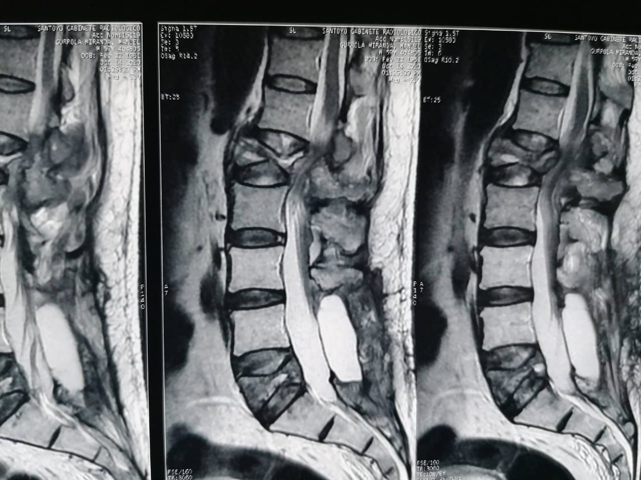 Juan José Luévano De La Cruz-51