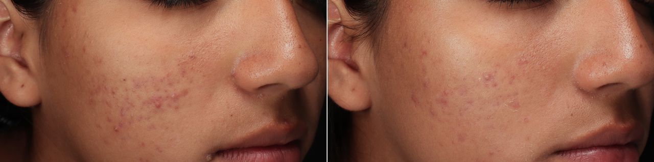 Lauro Francisco Varela Coronado-1