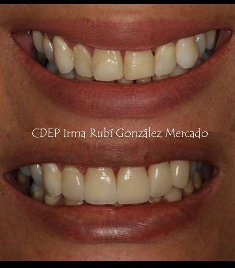 Irma Rubí González Mercado-0