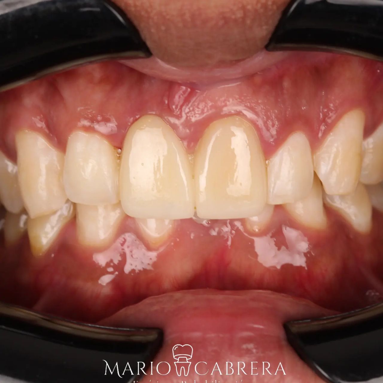 Mario Francisco Cabrera Ballona-4