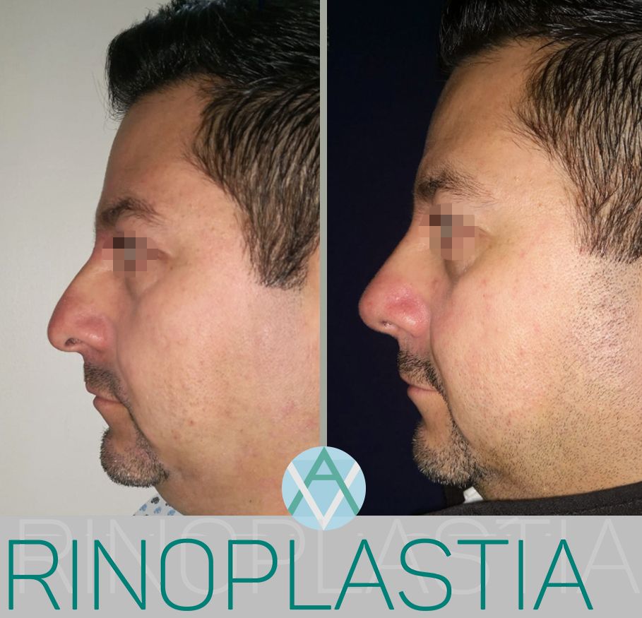 Alfonso Villaseñor Herrero-29