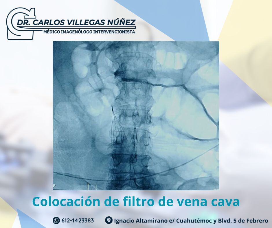 Carlos Enrique Villegas Nuñez-25