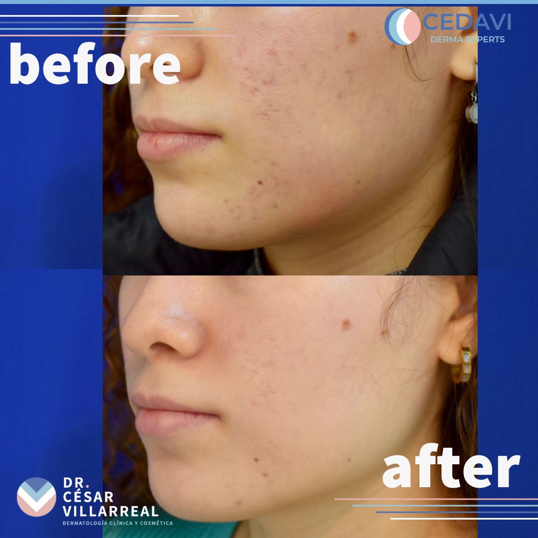 César Daniel Villarreal Villarreal-4