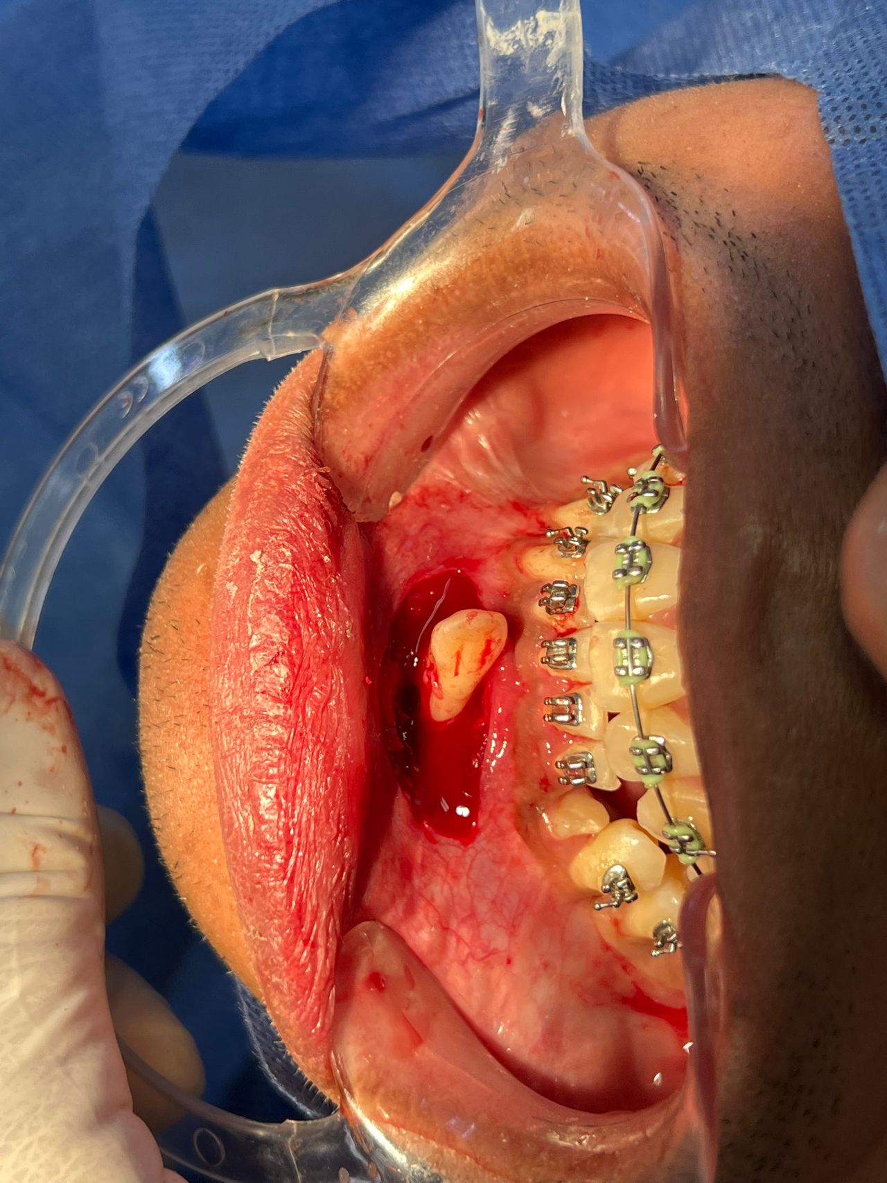 Luis Angel Carranza Resendez-5