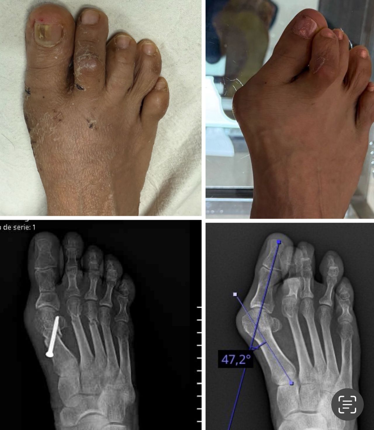 Carlos Tapia Hernández-7