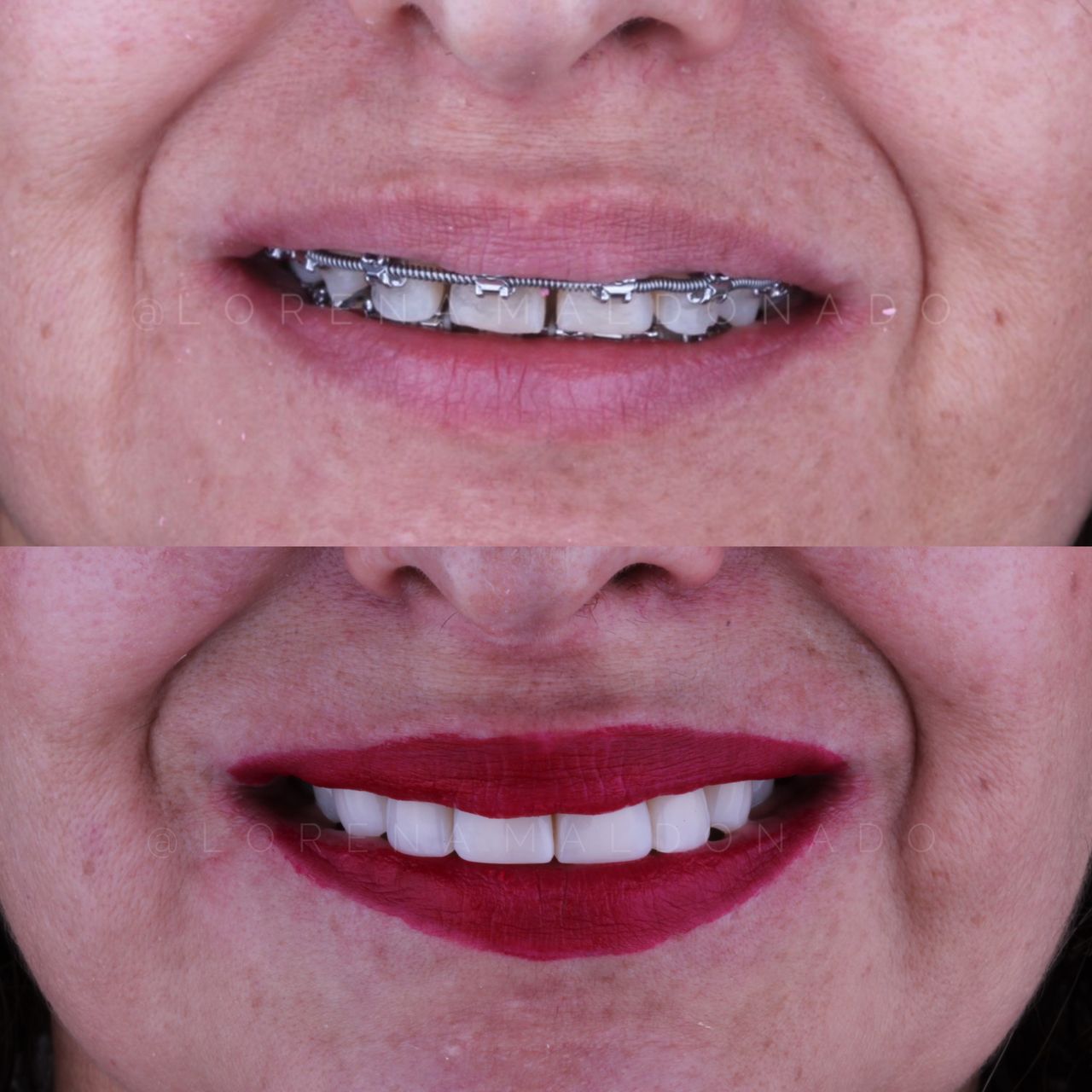 Ana Lorena Maldonado Munguia-9