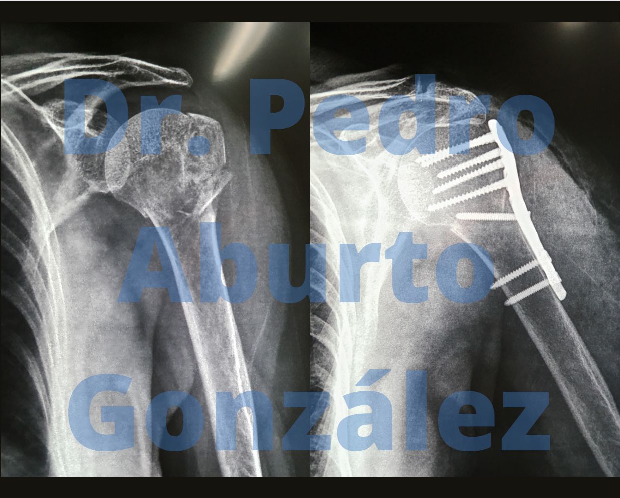 Pedro Aburto González-1