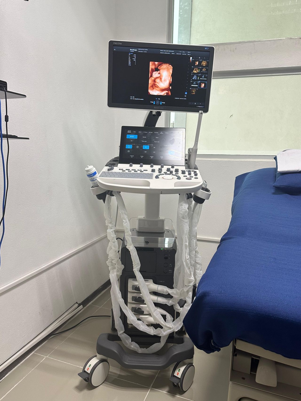 Abimelec Reyes Durán-7