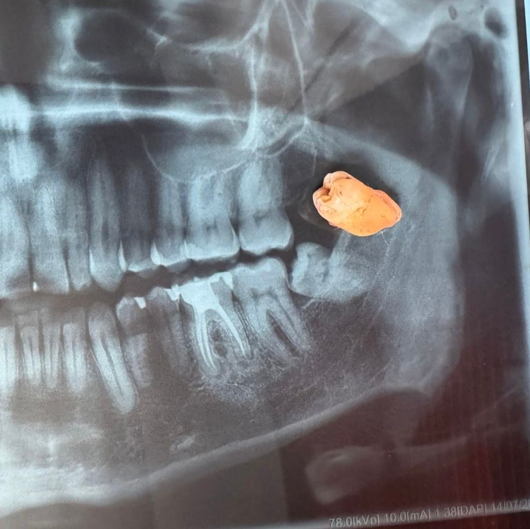 Luis Angel Carranza Resendez-11