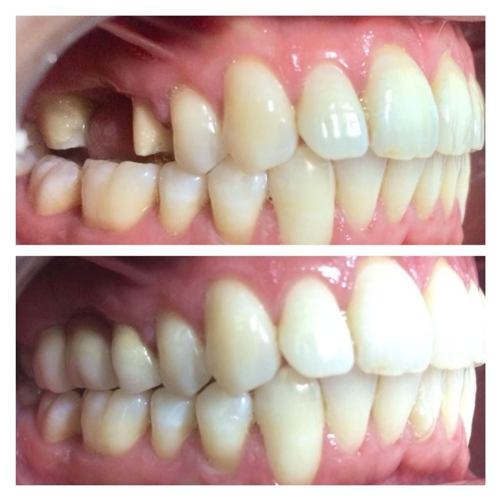 Jonathan Sandoval Robles-14