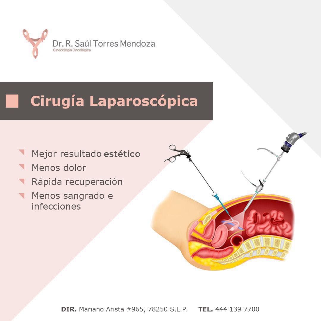 Rodolfo Saúl Torres Mendoza-12