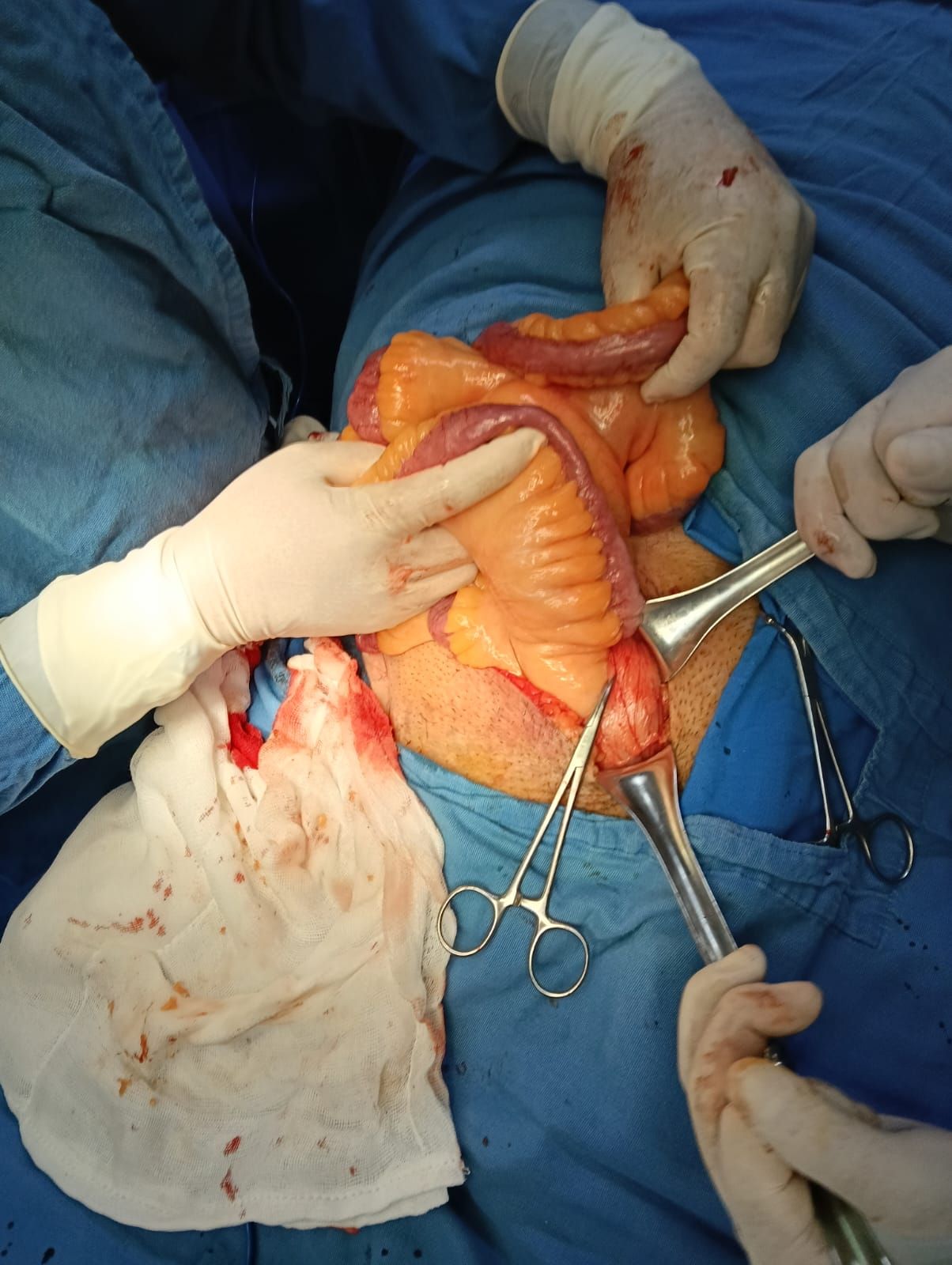 Alejandro Bailón Calderón-2