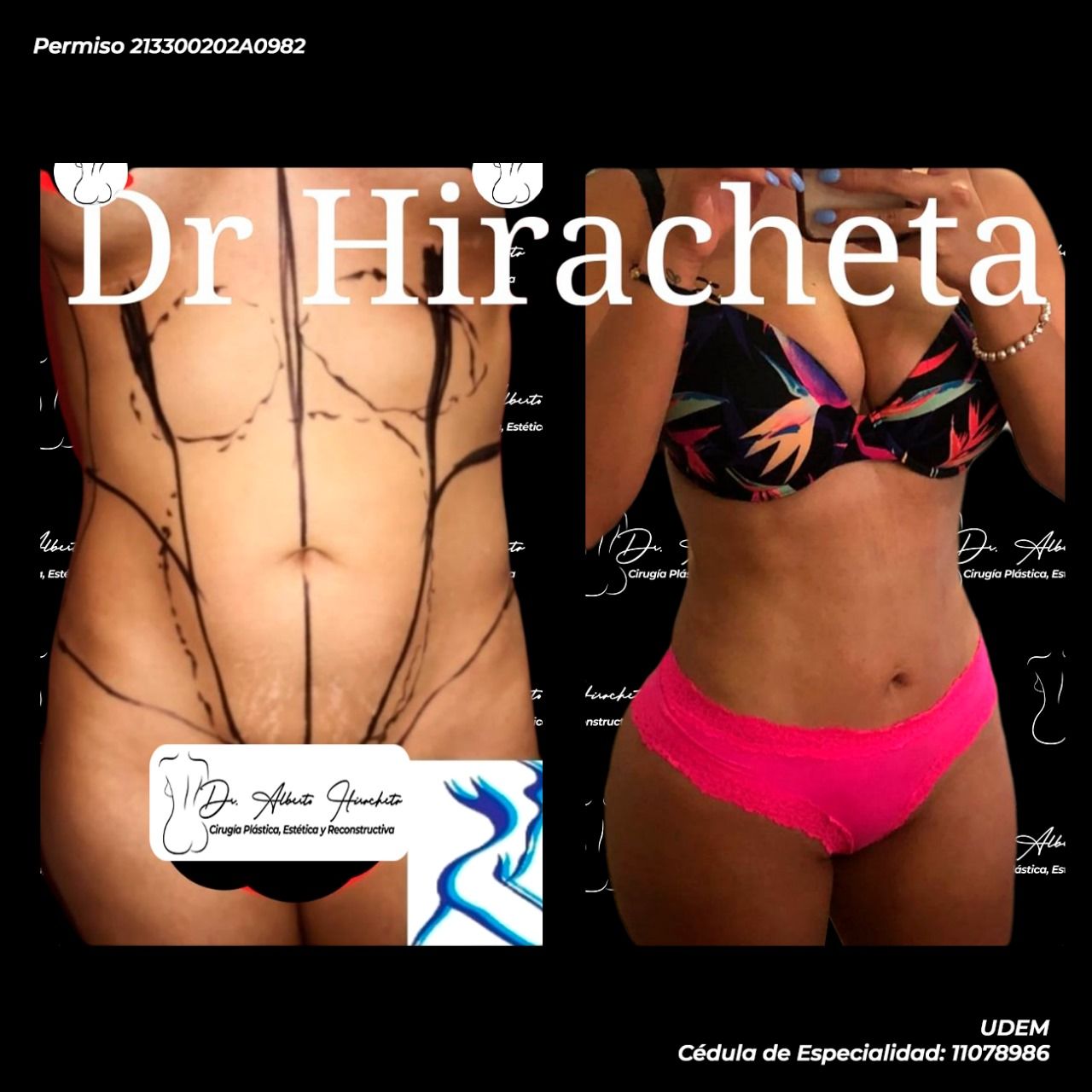 Alberto Hiracheta Torres-6