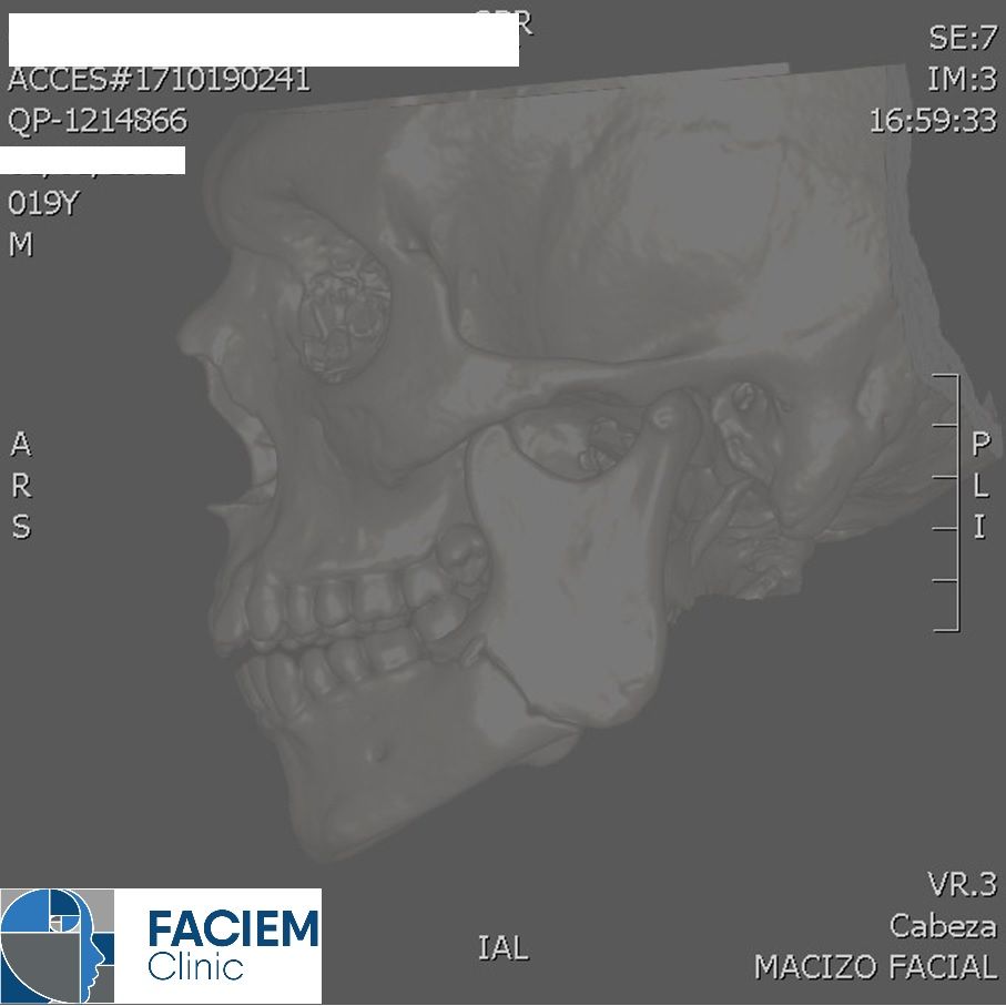Arlen Colín Ordaz-42
