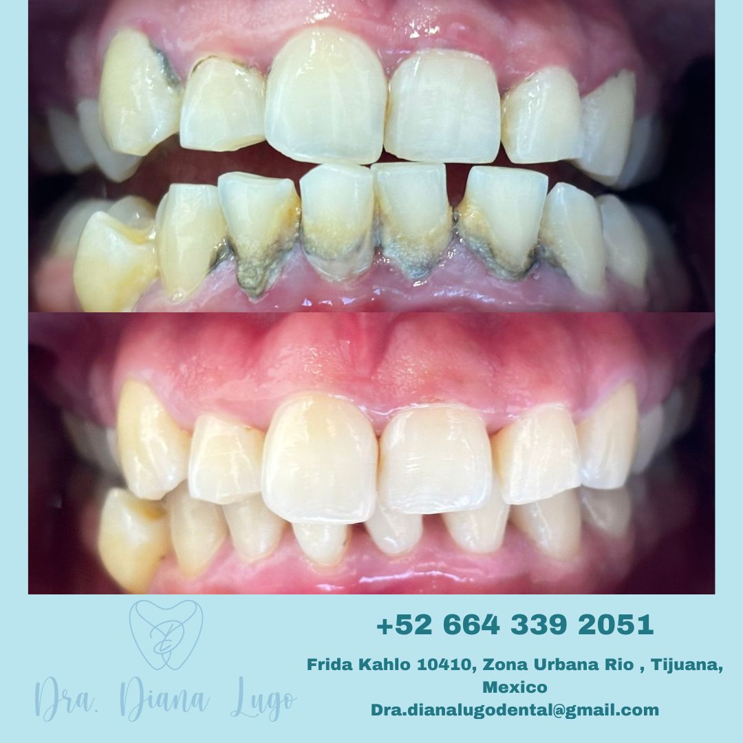 Diana Paola Lugo Bojorquez-14