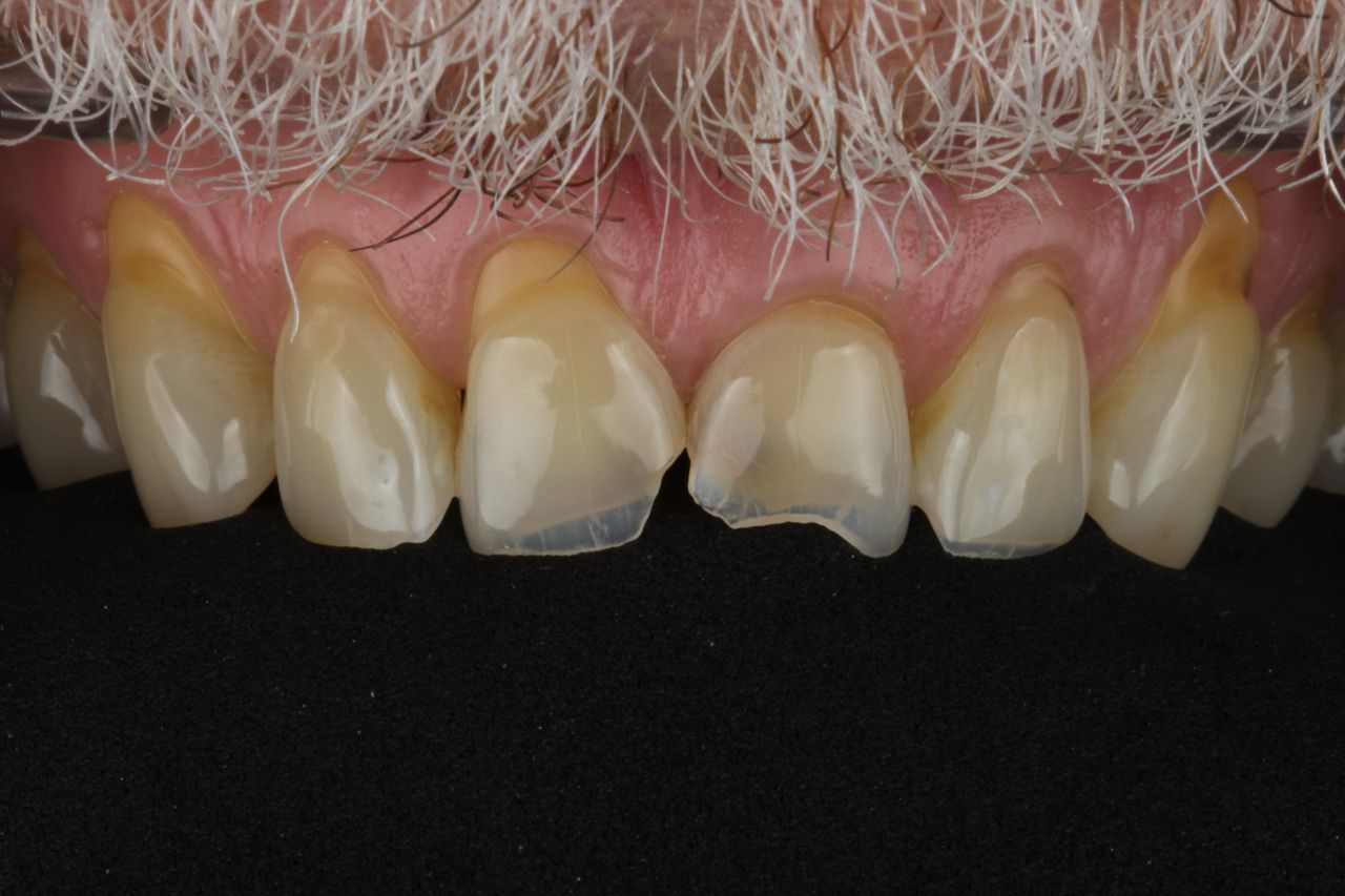 Sebastian Enrique Pérez Alvarez-3