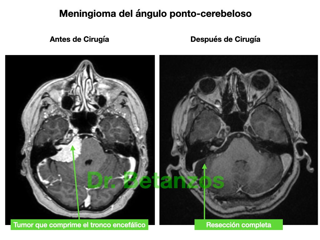 Aleixandre Betanzos Villegas-17