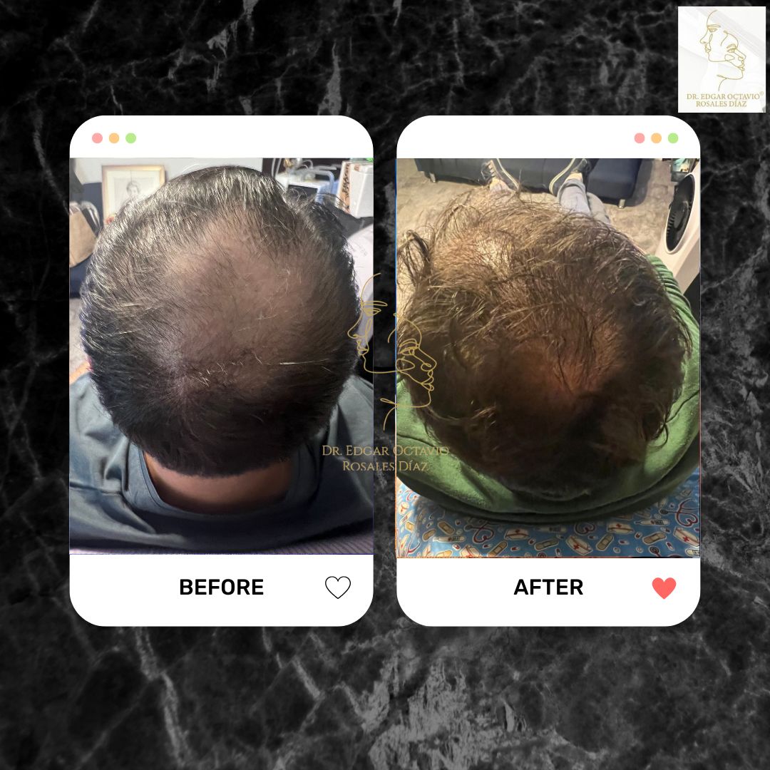 Edgar Octavio Rosales Diaz-6