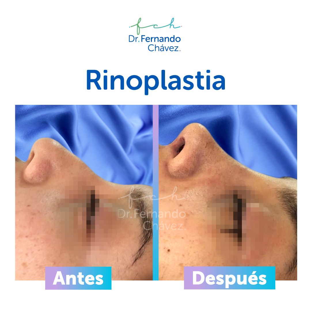 Fernando Chávez Osorio-9