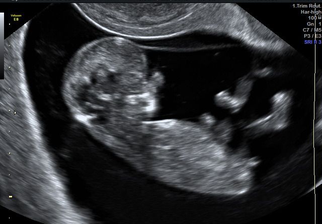 Graciela Elizabeth De La Torre Alvarez-18