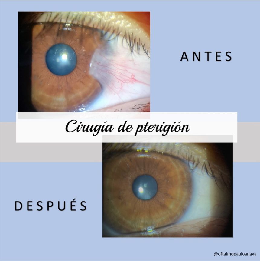 Paulo Roberto Anaya Delgadillo-2