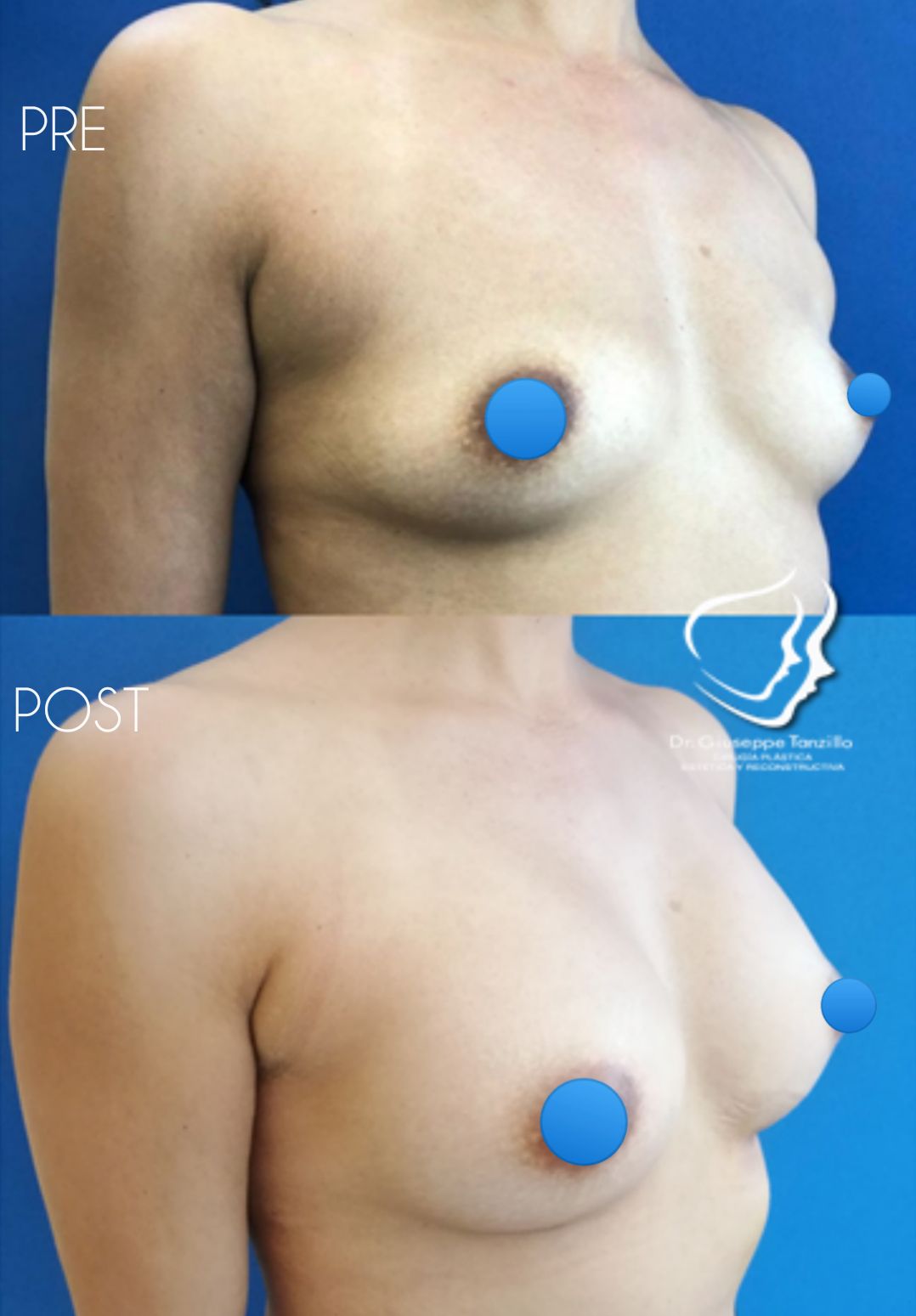 Giuseppe Tanzillo-67