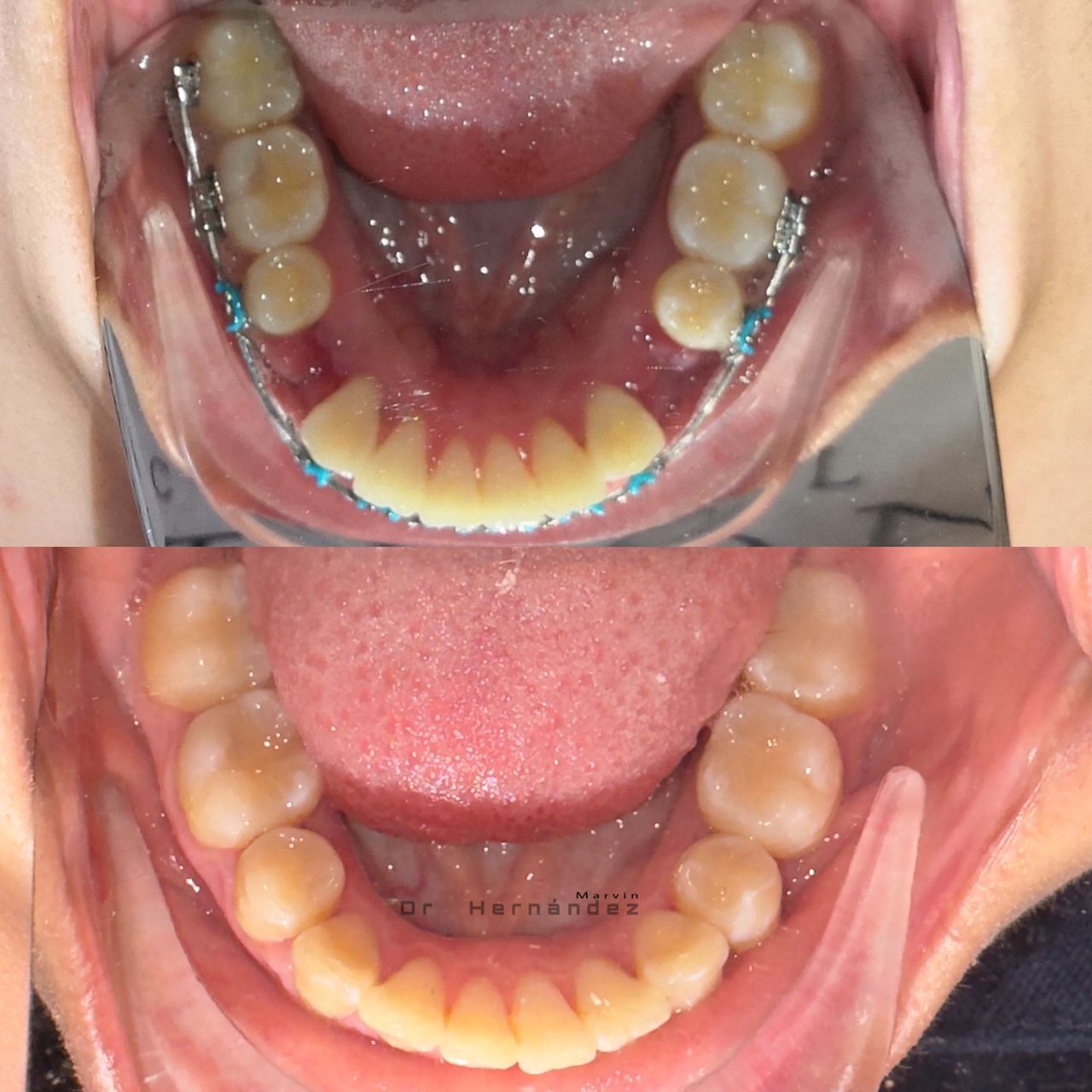 Marvin Adair Hernández Álvarez-23