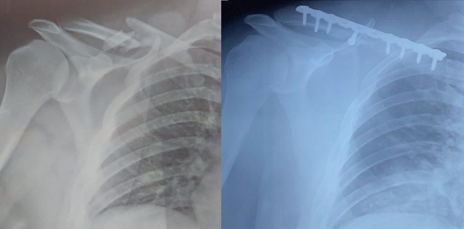 Luis Castañón Robles-20