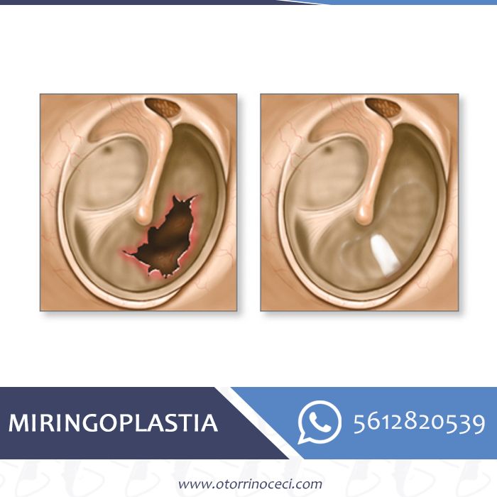 Cecilia Belen Espinosa Arce-21