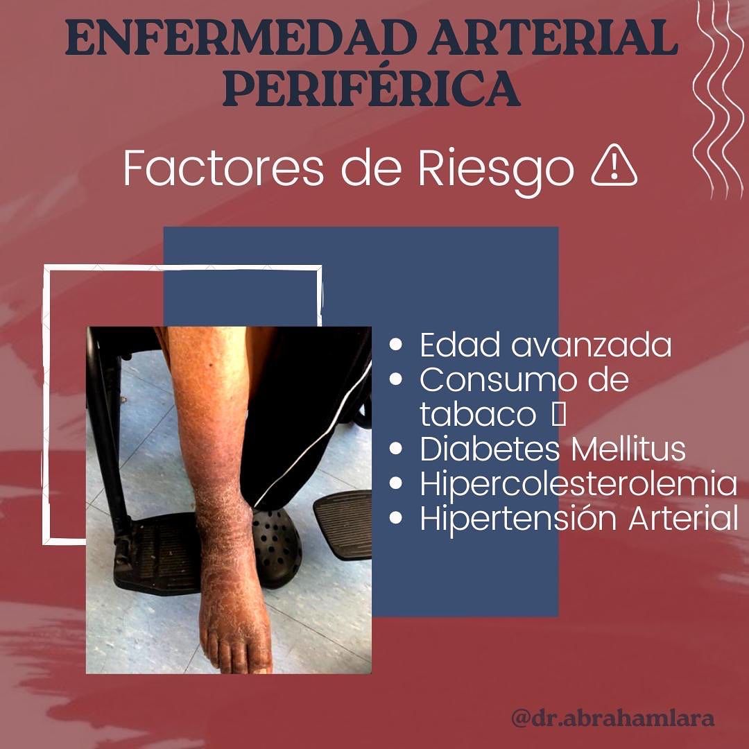 Miguel Abraham Lara Perez-29