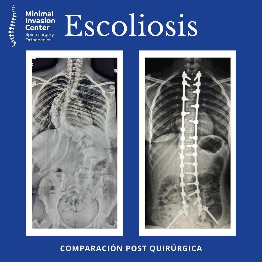 Omar Marroquín Herrera-32