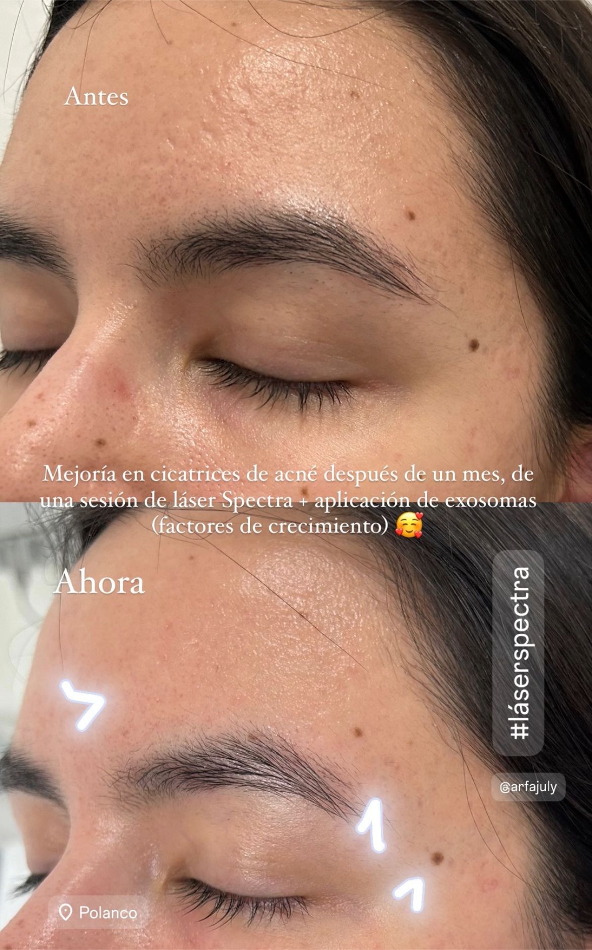 Ana Karen Romero Guzmán-0