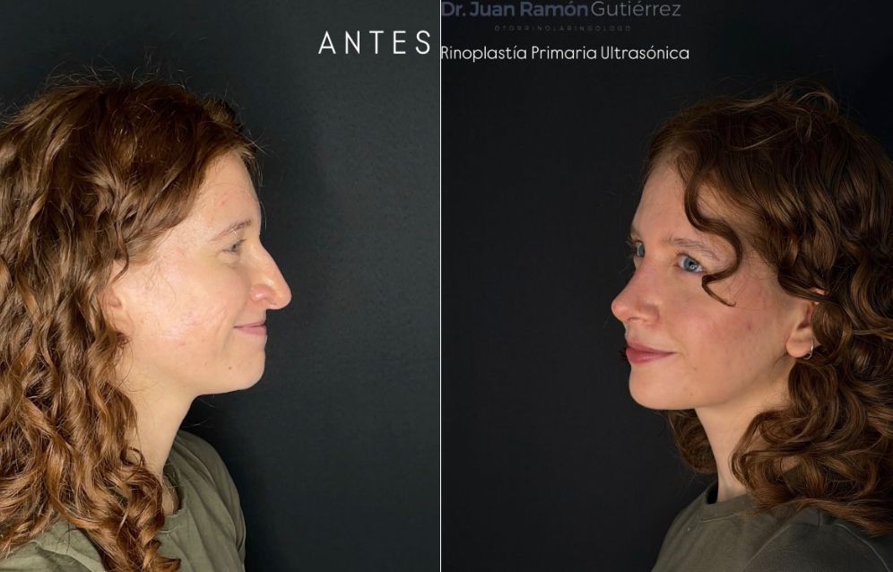 Juan Ramón Gutiérrez-1