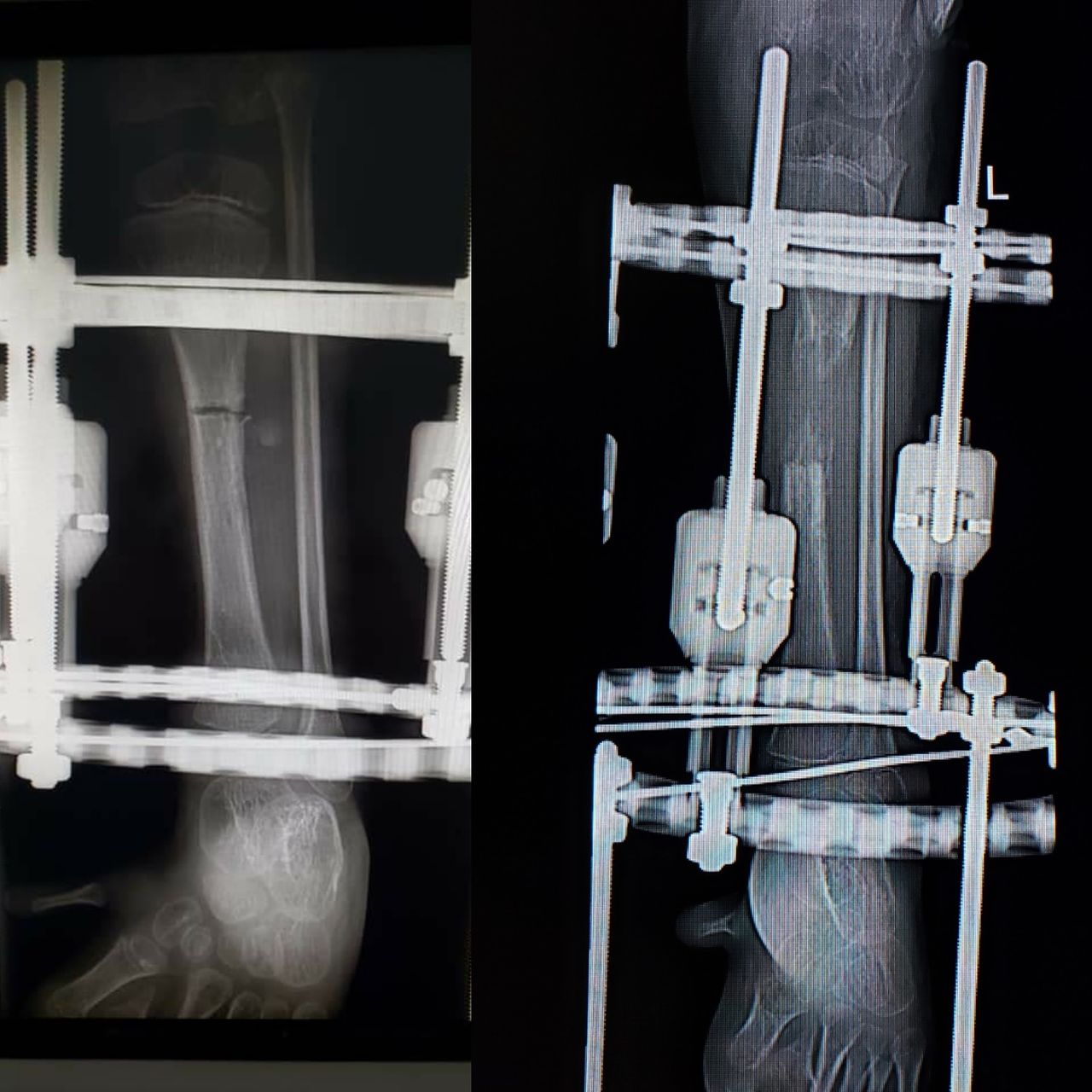 Alfonso Meza Vernis-92