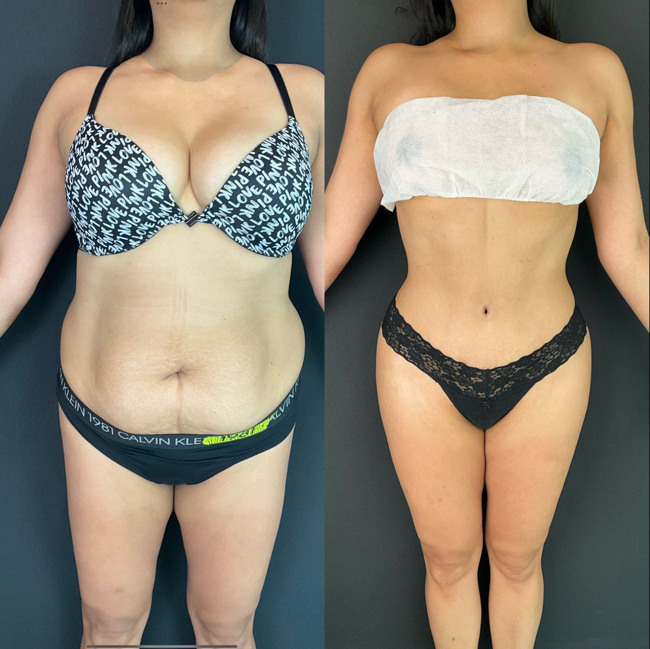 Giuseppe Tanzillo-13