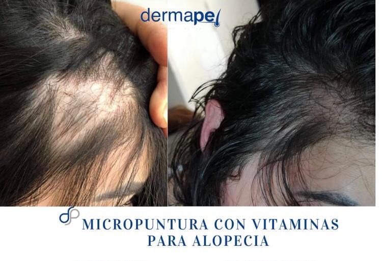 Maria De Lourdes Ascencio García-31