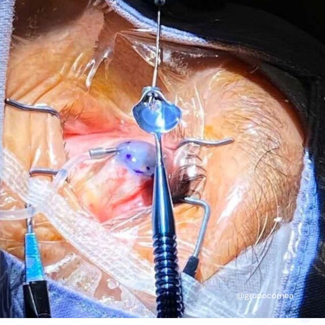 Kristian Alfonso Vazquez Romo-14