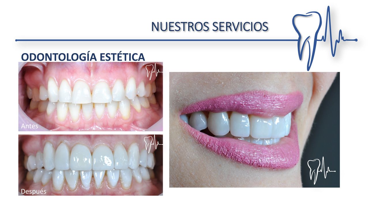 Alberto Companioni Bacha-18