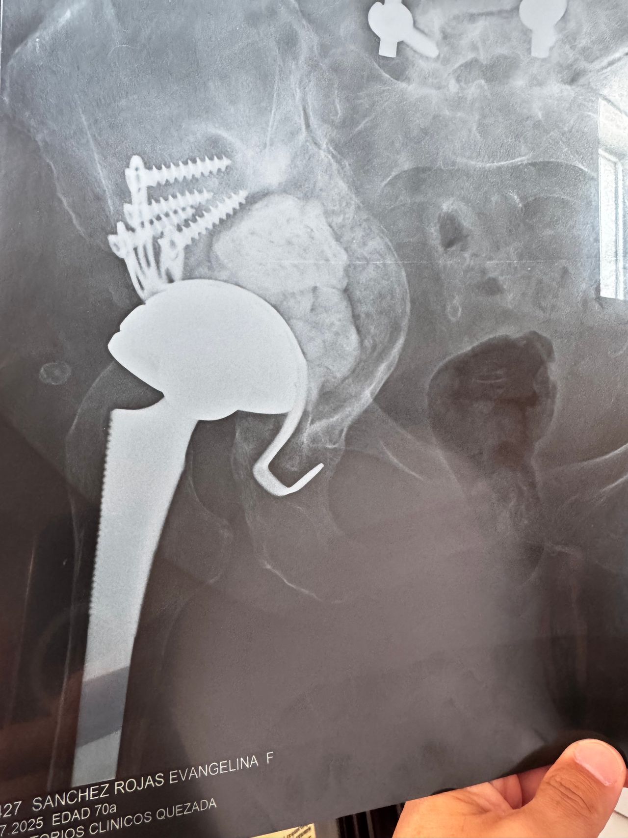 Benjamín Contreras Muñoz-13